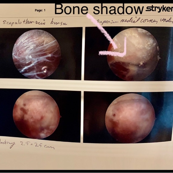Waiting on next specialist🧿Malpractice Complications🧿 - Picture 10 of 11